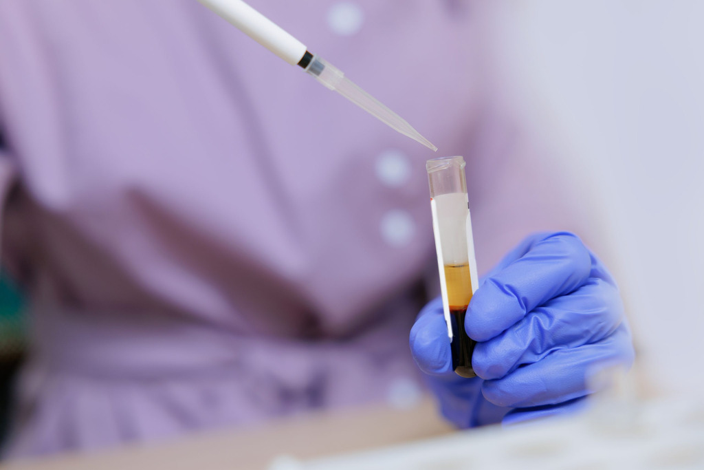 Strategic ambition requires operational realism: plasma-derived medicines and Europe’s health future